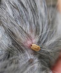 如何保护宠物狗狗在冬季免受蜱虫的困扰（有效防控蜱虫，让宠物狗狗健康成长）