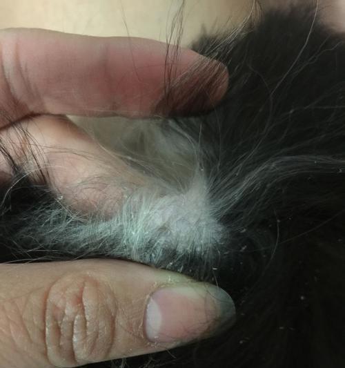 狗狗出现皮屑怎么办？解决方法大公开！（针对不同情况的皮屑问题，让宠物狗的健康之路更加通畅）