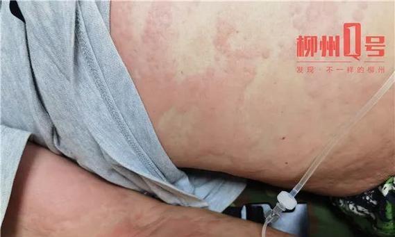喜乐蒂休克时的正确处理方法（宠物护理中必须掌握的技巧）