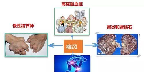 爱犬肾脏慢性衰竭的四种错误饲养方式（预防爱犬尿毒症，从正确的饲养方式开始）
