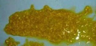 神秘的黄绿色液体究竟是什么？（解密这种神秘液体的成分及其意义）