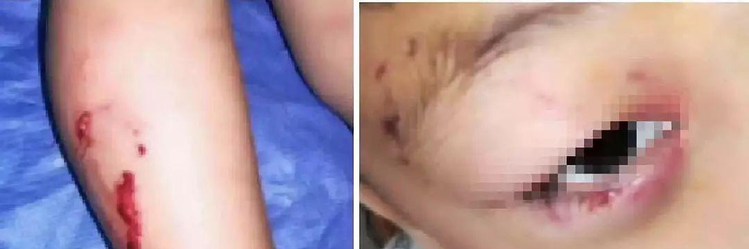 以狗打预防针，关注接种位置的重要性（如何选择最佳接种位置，确保疫苗有效性与犬只健康）