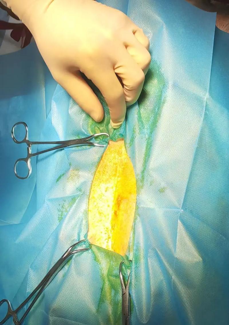狗狗剖腹产后症状（详解狗狗剖腹产后可能出现的症状及其原因）