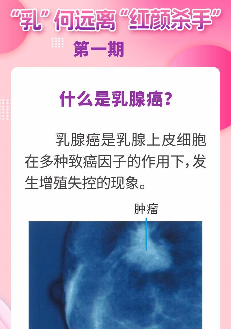 猫乳腺肿瘤（了解猫乳腺肿瘤的生存期和如何延长寿命）